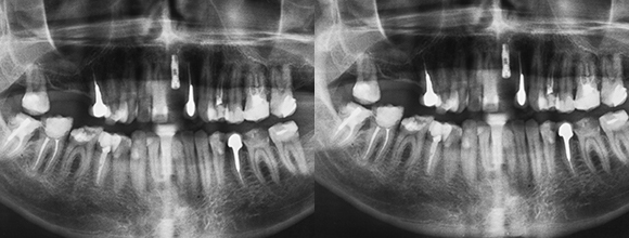 ġ�����Ļ���