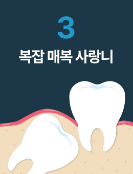 ���� �ź� �����