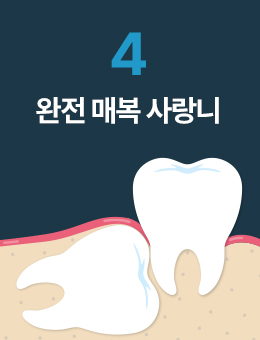 ���� �ź� �����